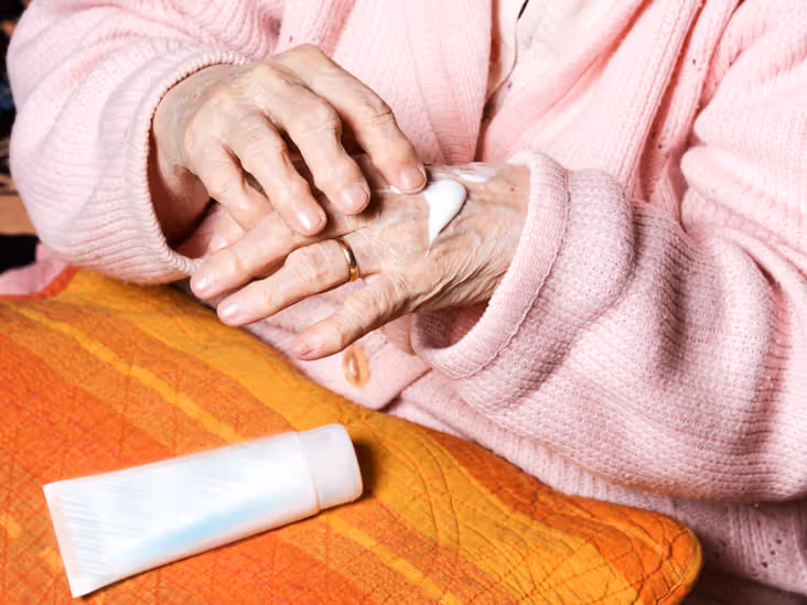 The Power of Arthritis Creams