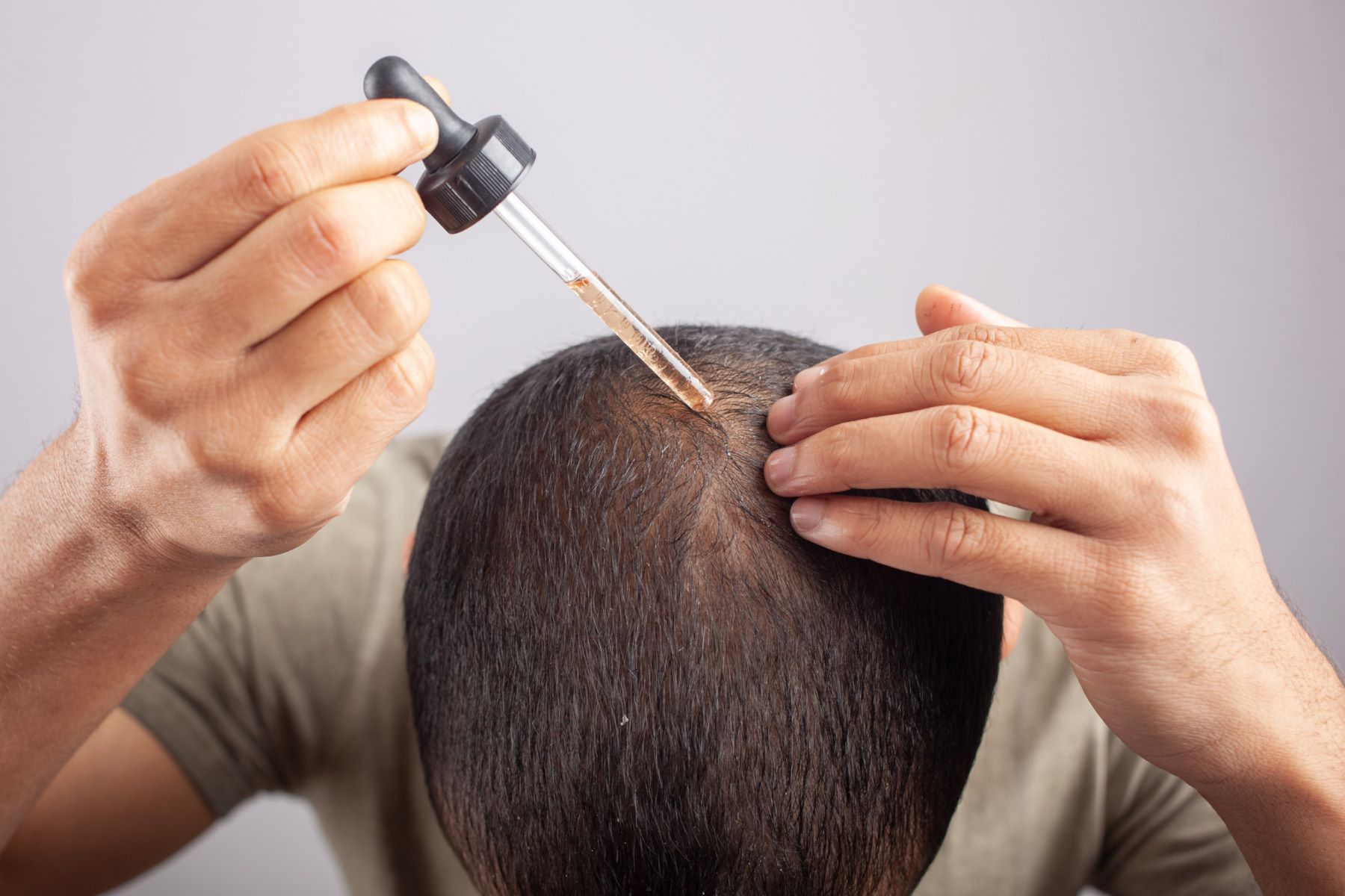 Rogaine for Men: Does it Really Work and What Makes it Manly?